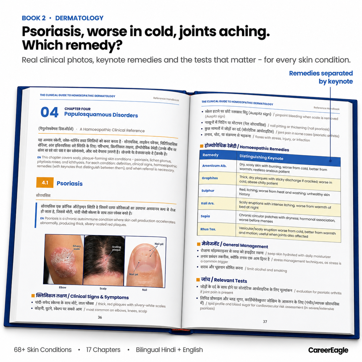 The Clinical Homoeopathy Combo: General Practice + Dermatology (हिंदी + English)