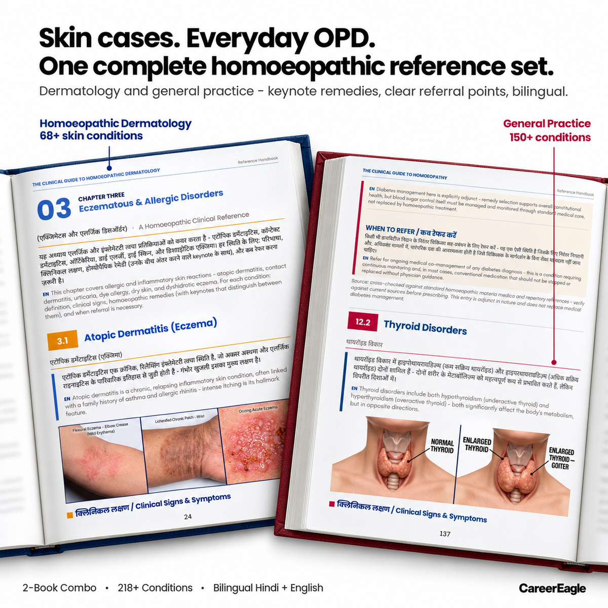 The Clinical Homoeopathy Combo: General Practice + Dermatology (हिंदी + English)