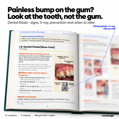 The Clinical Guide to Dental & Oral Diseases - हिंदी + English